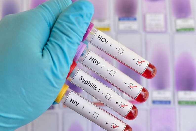 Pruebas ITS en Cuautitlán Izcalli